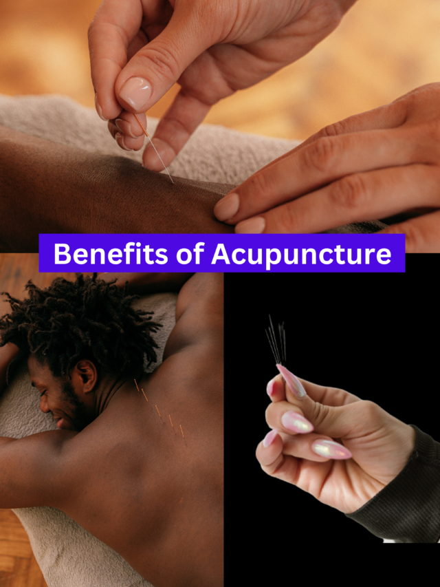 Benefits of Acupuncture